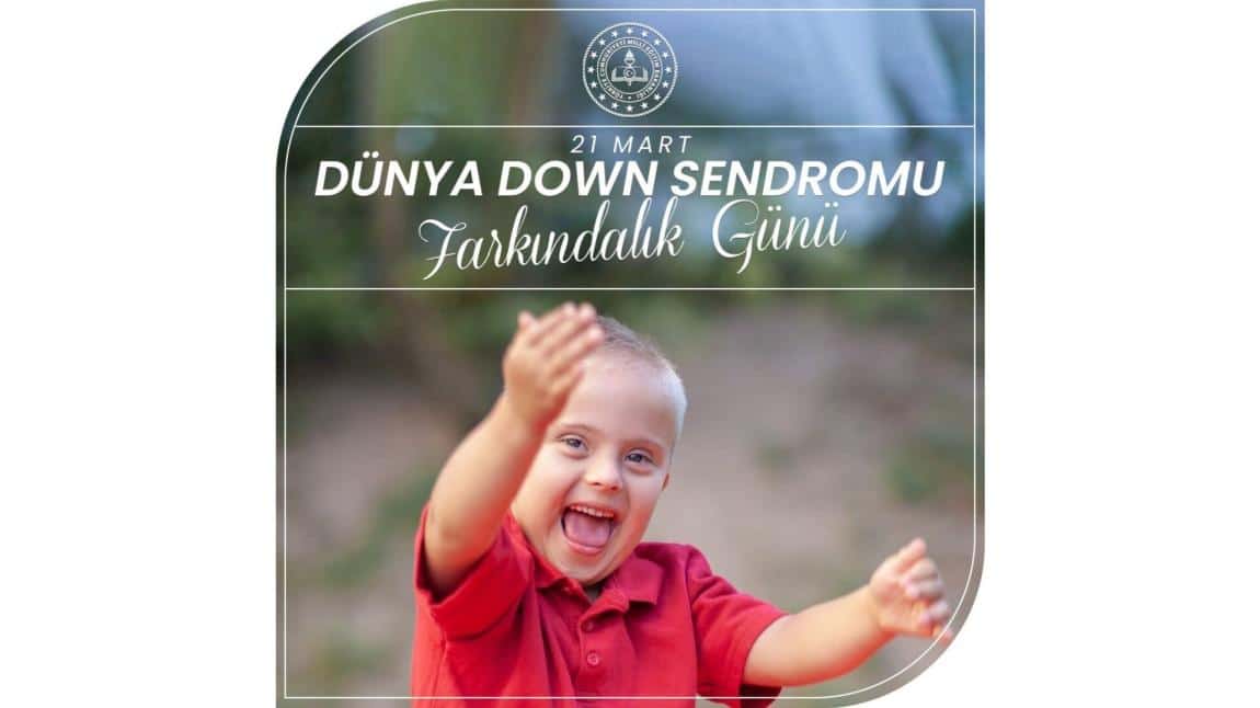 21 Mart Dünya Down Sendromu Farkındalık Günü